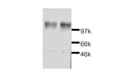 Anti-Leptin Receptor antibody used in Western Blot (WB). GTX27211
