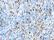 Anti-MyoD1 antibody [5.2F] (ready-to-use) used in IHC (Paraffin sections) (IHC-P). GTX27272
