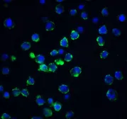 Anti-Acinus antibody used in Immunocytochemistry/ Immunofluorescence (ICC/IF). GTX27352