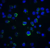 Anti-Acinus antibody used in Immunocytochemistry/ Immunofluorescence (ICC/IF). GTX27355