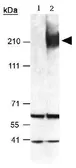Anti-ABCA1 antibody used in Western Blot (WB). GTX27360