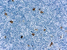 Anti-SSEA-1 / CD15 antibody [MMA(LeuM1)] (ready-to-use) used in IHC (Paraffin sections) (IHC-P). GTX27495