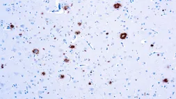 Anti-beta Amyloid (1-40) antibody [BAM-10] used in IHC (Paraffin sections) (IHC-P). GTX27501