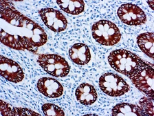 Anti-Cytokeratin 8 antibody [35&#946;H11] (ready-to-use) used in IHC (Paraffin sections) (IHC-P). GTX27506