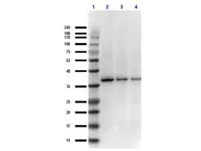 Anti-IKB beta antibody used in Western Blot (WB). GTX27547