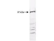 Anti-IKK beta antibody used in Western Blot (WB). GTX27611