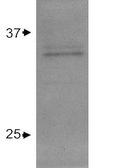 Anti-Apolipoprotein E antibody used in Western Blot (WB). GTX27620