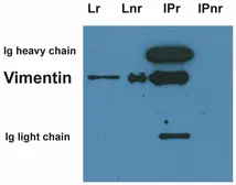 Anti-Vimentin antibody [VI-01] used in Western Blot (WB). GTX27752