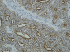 Anti-pan Cytokeratin antibody [C-11] used in IHC (Paraffin sections) (IHC-P). GTX27753