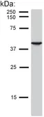 Anti-Cytokeratin 19 antibody [BA-17] used in Western Blot (WB). GTX27755