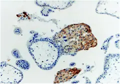Anti-HLA-G antibody [MEM-G/1] used in IHC (Paraffin sections) (IHC-P). GTX27759
