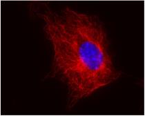 Anti-beta Tubulin antibody [TU-06] used in Immunocytochemistry/ Immunofluorescence (ICC/IF). GTX27792