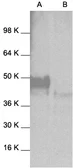 Anti-JNK1 antibody used in Western Blot (WB). GTX27949