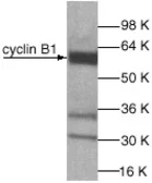 Anti-Cyclin B1 antibody used in Western Blot (WB). GTX27957