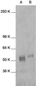 Anti-c-Fos antibody used in Western Blot (WB). GTX27963