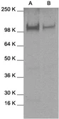 Anti-STAT2 antibody used in Western Blot (WB). GTX27965