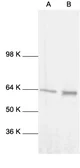 Anti-NFkB p65 antibody used in Western Blot (WB). GTX27970