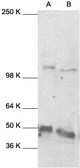 Anti-NFkB p105/p50 antibody used in Western Blot (WB). GTX27971