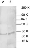 Anti-Caspase 1 antibody used in Western Blot (WB). GTX27978
