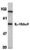 Anti-IL1RAP antibody used in Western Blot (WB). GTX28109