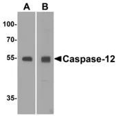 Anti-Caspase 12 antibody used in Western Blot (WB). GTX28117