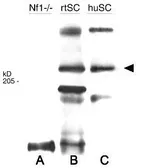 Anti-Neurofibromin antibody used in Western Blot (WB). GTX28132