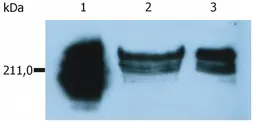 Anti-CD45RA antibody [MEM-56] used in Western Blot (WB). GTX28217
