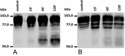 Anti-CD18 antibody [MEM-148] used in Western Blot (WB). GTX28220