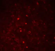 Anti-TMS1 antibody used in IHC (Paraffin sections) (IHC-P). GTX28394