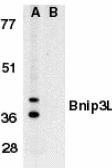 Anti-BNIP3L antibody used in Western Blot (WB). GTX28399
