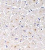 Anti-DcR3 antibody used in IHC (Paraffin sections) (IHC-P). GTX28405