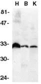 Anti-DcR3 antibody used in Western Blot (WB). GTX28405