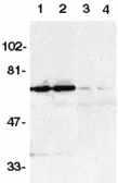 Anti-DR6 antibody used in Western Blot (WB). GTX28417