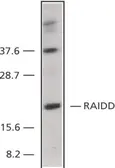 Anti-RAIDD antibody, C-term used in Western Blot (WB). GTX28425