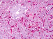 Anti-NOTCH1 antibody used in IHC (Paraffin sections) (IHC-P). GTX28925