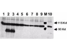 Anti-NOTCH1 antibody used in Western Blot (WB). GTX28925