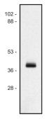 Anti-HLA Class I antibody [MEM-147] used in Western Blot (WB). GTX29090