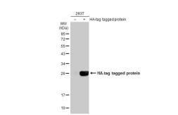 Anti-HA tag antibody used in Western Blot (WB). GTX29110