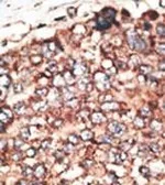 Anti-MMP17 antibody used in IHC (Paraffin sections) (IHC-P). GTX29125