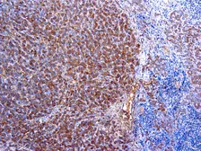 Anti-alpha 1 Antitrypsin antibody used in IHC (Paraffin sections) (IHC-P). GTX29373