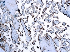 Anti-hCG beta antibody used in IHC (Paraffin sections) (IHC-P). GTX29376