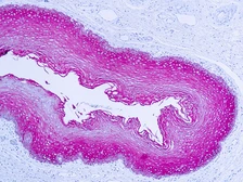 Anti-pan Cytokeratin antibody used in IHC (Paraffin sections) (IHC-P). GTX29377
