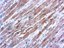 Anti-sarcomeric alpha Actinin antibody [EA-53] used in IHC (Paraffin sections) (IHC-P). GTX29465