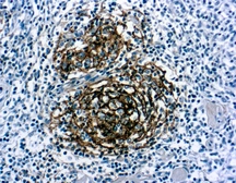 Anti-CD21 antibody [1F8] used in IHC (Paraffin sections) (IHC-P). GTX29492