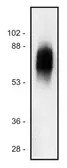 Anti-SIT antibody [SIT-01] used in Western Blot (WB). GTX29528