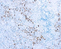 Anti-HSV1 antibody used in IHC (Paraffin sections) (IHC-P). GTX29533