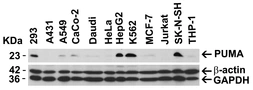 Anti-PUMA antibody used in Western Blot (WB). GTX29643