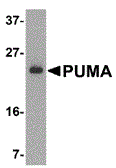 Anti-PUMA antibody used in Western Blot (WB). GTX29645