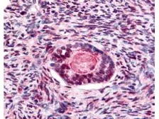 Anti-GSK3 beta (phospho Ser9) antibody used in IHC (Paraffin sections) (IHC-P). GTX29769