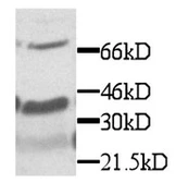 Anti-CX3CL1 antibody used in Western Blot (WB). GTX29819